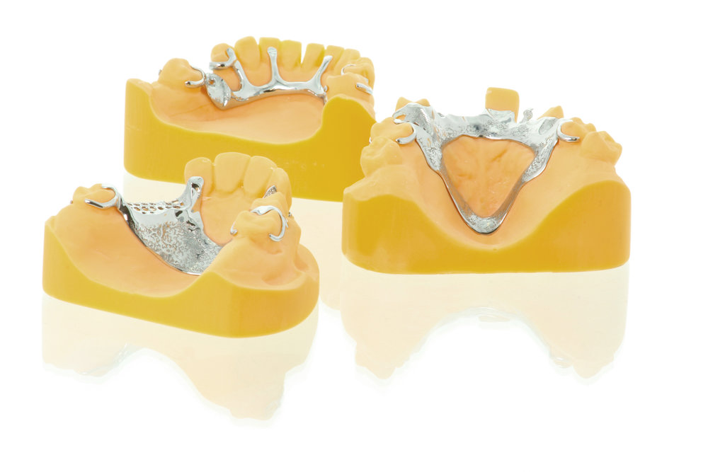 Egan adopts digital workflow for Removable Partial Dentures (RPD)